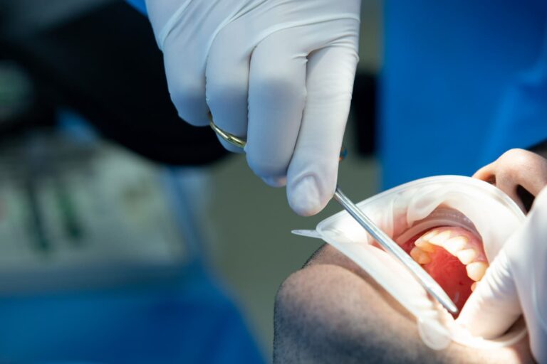 Dentista Herramienta Realiza Algunas Manipulaciones Boca Paciente (1)