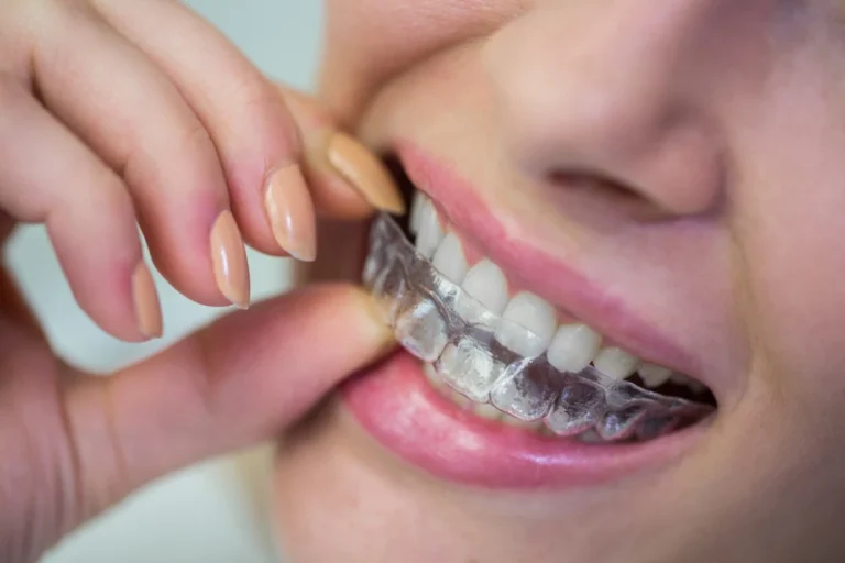 Mujer Probándose Su Aparato De Invisalign En El Dentista